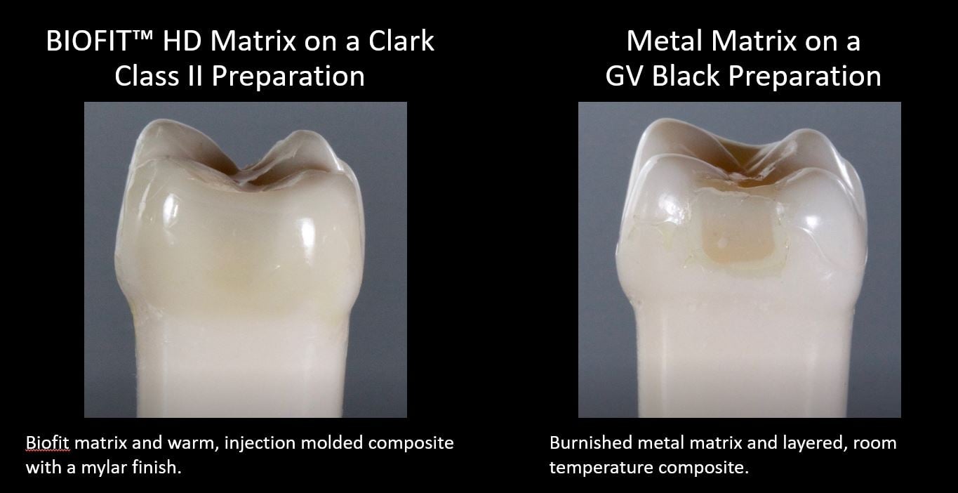 Biofit HD matrix compared with a metal matrix